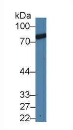 Prothrombin Antibody in Western Blot (WB)