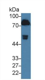 Prothrombin Antibody in Western Blot (WB)