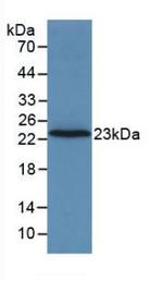 Prothrombin Antibody in Western Blot (WB)