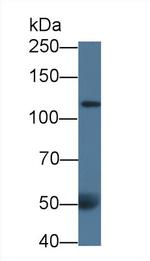 Collagen III Antibody in Western Blot (WB)