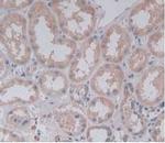 PLA2G4A Antibody in Immunohistochemistry (Paraffin) (IHC (P))