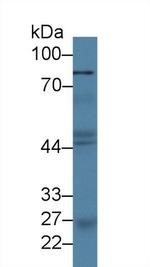 PLA2G4A Antibody in Western Blot (WB)