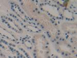 DKK1 Antibody in Immunohistochemistry (Paraffin) (IHC (P))