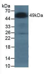 alpha Galactosidase Antibody in Western Blot (WB)