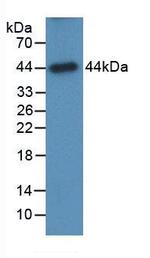 alpha Galactosidase Antibody in Western Blot (WB)