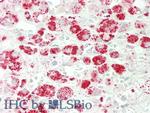 alpha Galactosidase Antibody in Immunohistochemistry (Paraffin) (IHC (P))