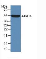 alpha Galactosidase Antibody in Western Blot (WB)