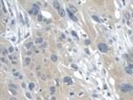 Galectin 2 Antibody in Immunohistochemistry (Paraffin) (IHC (P))