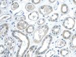 Galectin 2 Antibody in Immunohistochemistry (Paraffin) (IHC (P))