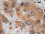 GLUT1 Antibody in Immunohistochemistry (Paraffin) (IHC (P))