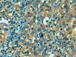 HSPA1L Antibody in Immunohistochemistry (Paraffin) (IHC (P))