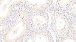 HSPA1B Antibody in Immunohistochemistry (Paraffin) (IHC (P))