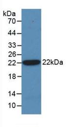 SHH Antibody in Western Blot (WB)