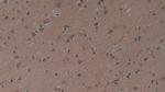 HFE2 Antibody in Immunohistochemistry (Paraffin) (IHC (P))