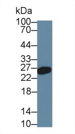 HFE2 Antibody in Western Blot (WB)