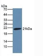 HFE2 Antibody in Western Blot (WB)