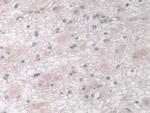 IGFBP4 Antibody in Immunohistochemistry (Paraffin) (IHC (P))