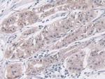 IGFBP4 Antibody in Immunohistochemistry (Paraffin) (IHC (P))