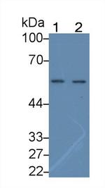 IFNAR1 Antibody in Western Blot (WB)