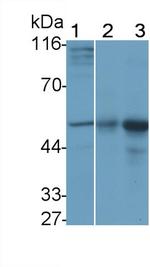 IFNAR1 Antibody in Western Blot (WB)