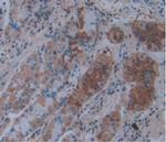 IL-1 alpha Antibody in Immunohistochemistry (Paraffin) (IHC (P))