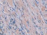 IL-1 alpha Antibody in Immunohistochemistry (Paraffin) (IHC (P))