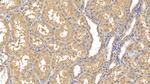 MMP8 Antibody in Immunohistochemistry (Paraffin) (IHC (P))