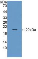 MMP9 Antibody in Western Blot (WB)