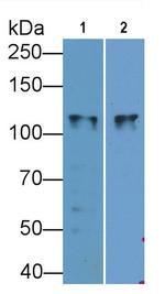 SLC12A3 Antibody in Western Blot (WB)