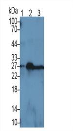 NGAL Antibody in Western Blot (WB)