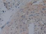 Noggin Antibody in Immunohistochemistry (Paraffin) (IHC (P))