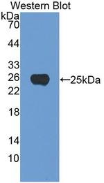 Noggin Antibody in Western Blot (WB)