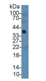 PTHLH Antibody in Western Blot (WB)