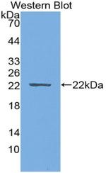 PTHLH Antibody in Western Blot (WB)