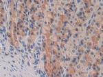 PPAR gamma Antibody in Immunohistochemistry (Paraffin) (IHC (P))