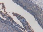 PPAR gamma Antibody in Immunohistochemistry (Paraffin) (IHC (P))