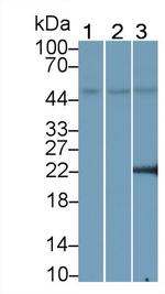 PPAR gamma Antibody in Western Blot (WB)