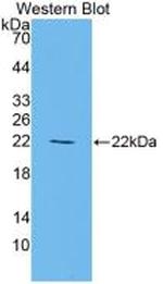 PPAR gamma Antibody in Western Blot (WB)