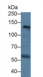 Procollagen I N-Peptide Antibody in Western Blot (WB)