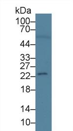 RBP4 Antibody in Western Blot (WB)