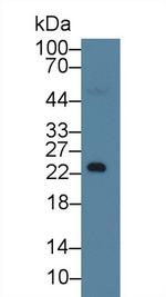 RBP4 Antibody in Western Blot (WB)