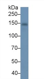 RBP4 Antibody in Western Blot (WB)