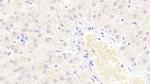 S100A9 Antibody in Immunohistochemistry (Paraffin) (IHC (P))