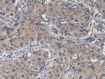 SAA Antibody in Immunohistochemistry (Paraffin) (IHC (P))