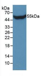 STC1 Antibody in Western Blot (WB)