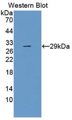 TLR5 Antibody in Western Blot (WB)