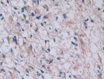 Tryptase Antibody in Immunohistochemistry (Paraffin) (IHC (P))