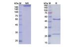 Bevacizumab Humanized Antibody in SDS-PAGE (SDS-PAGE)