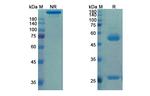 Matuzumab Humanized Antibody in SDS-PAGE (SDS-PAGE)