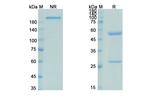 Pascolizumab Humanized Antibody in SDS-PAGE (SDS-PAGE)